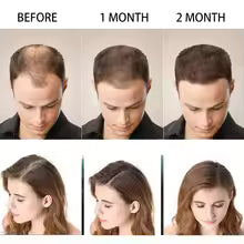 Shampoo Anticaída | Hair Care Disaar